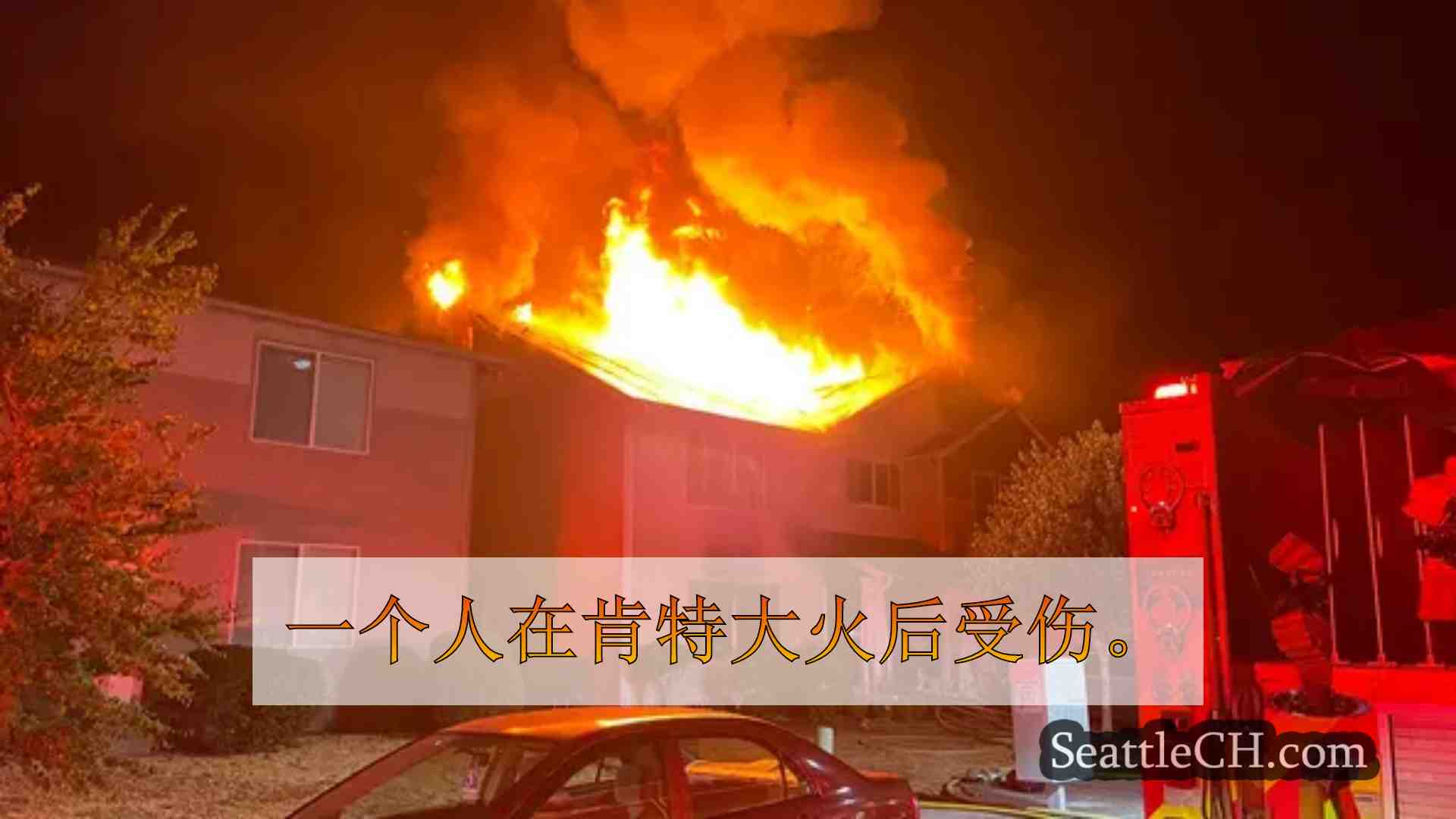 1肯特之家大火后住院