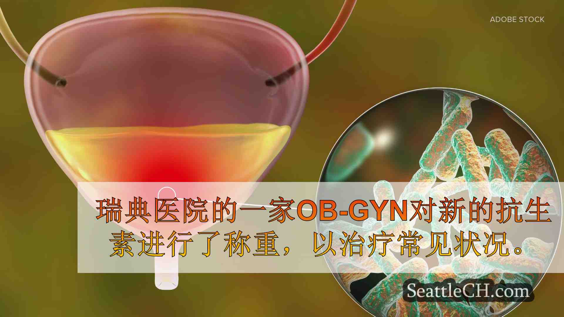 在美国批准的新抗生素治疗尿路感染：HealthLink