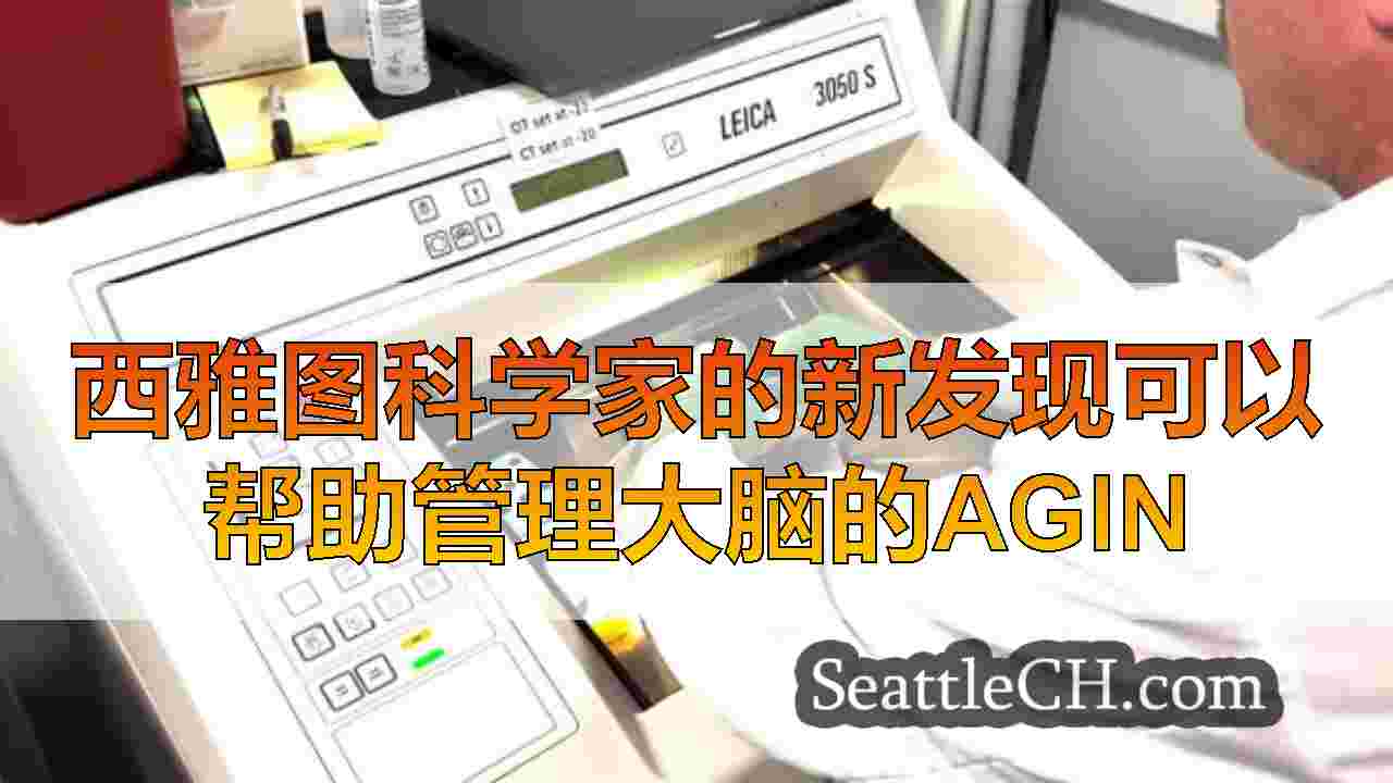 西雅图科学家的新发现可以帮助管理大脑的衰老过程