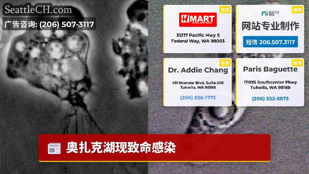 奥扎克湖现致命感染