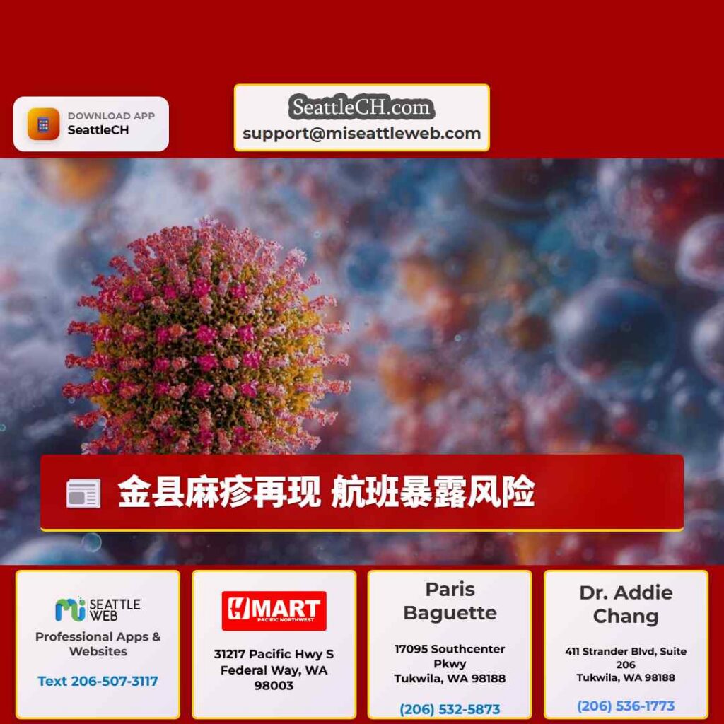 金县麻疹再现 航班暴露风险