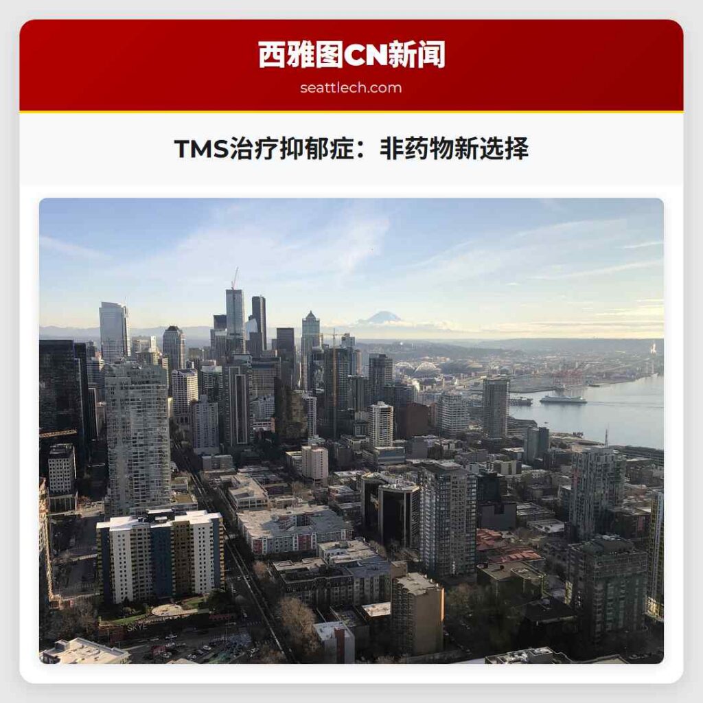 TMS治疗抑郁症：非药物新选择