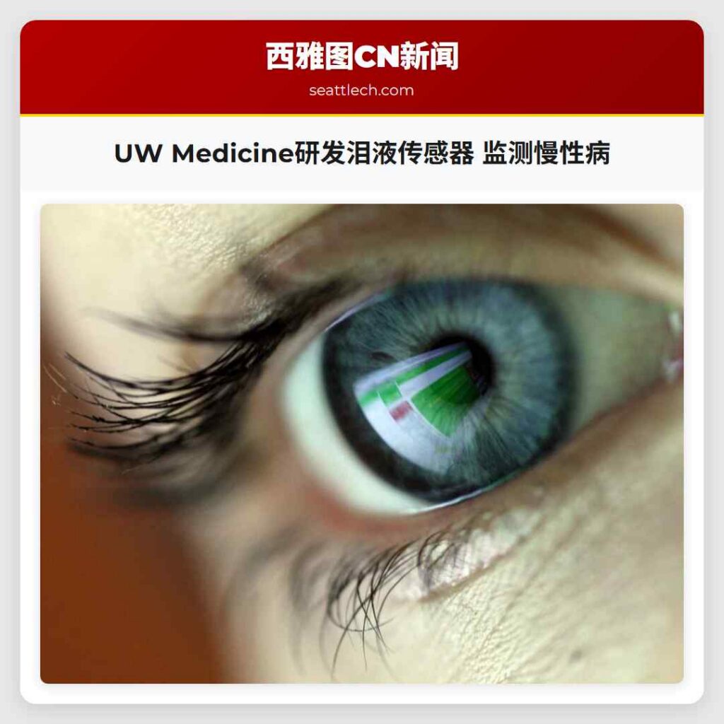 UW Medicine研发泪液传感器 监测慢性病