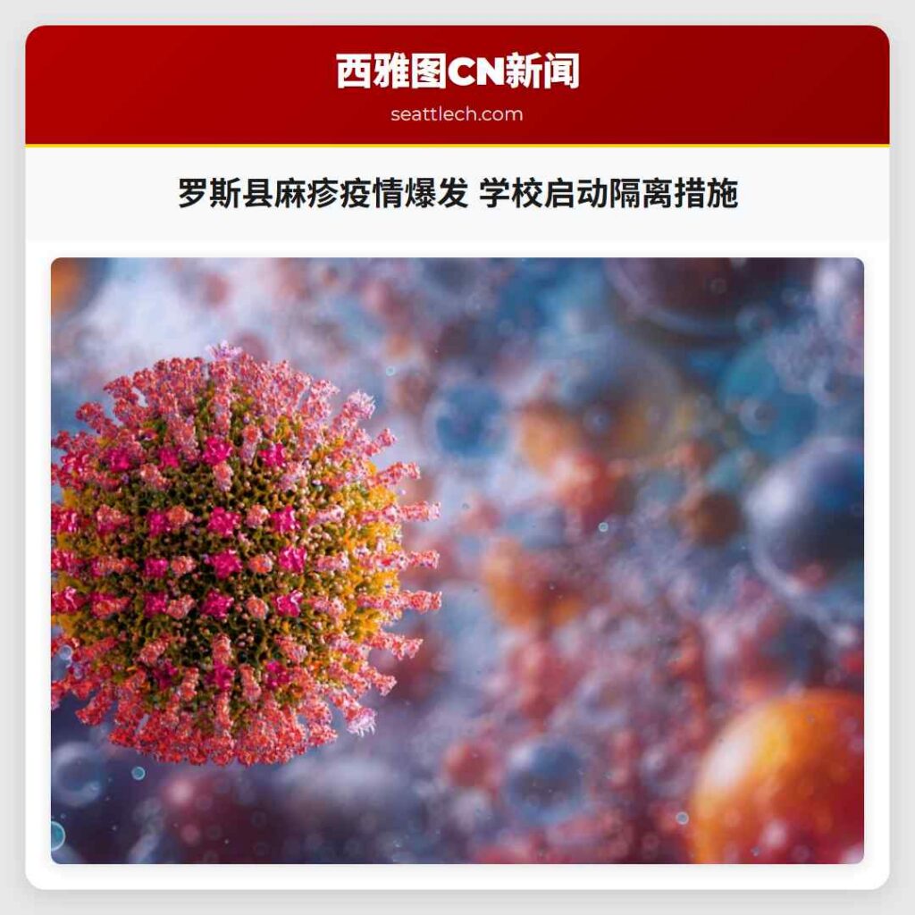 罗斯县麻疹疫情爆发 学校启动隔离措施