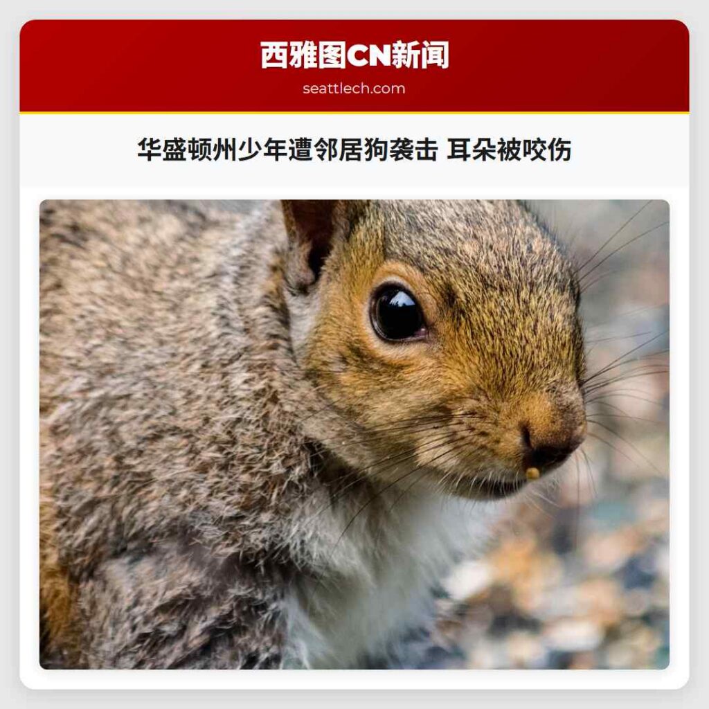 华盛顿州少年遭邻居狗袭击 耳朵被咬伤