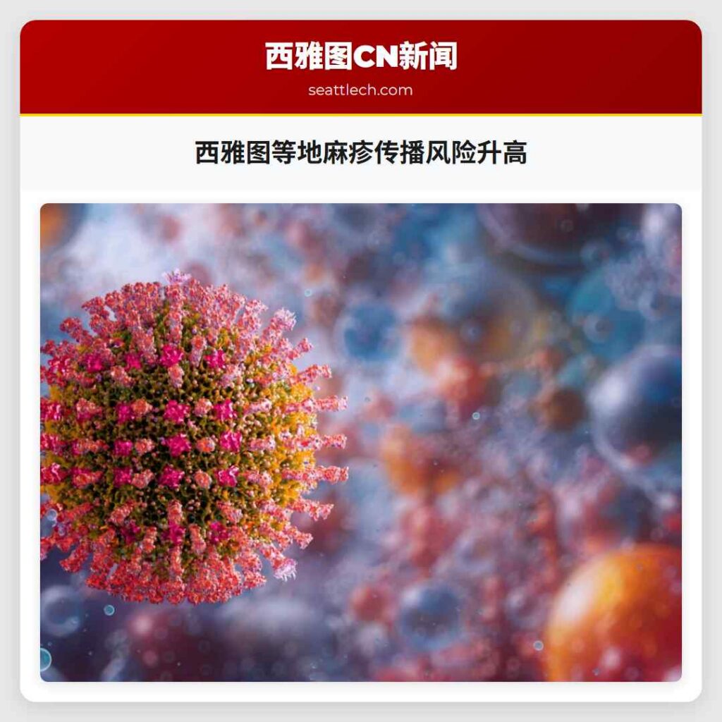 西雅图等地麻疹传播风险升高