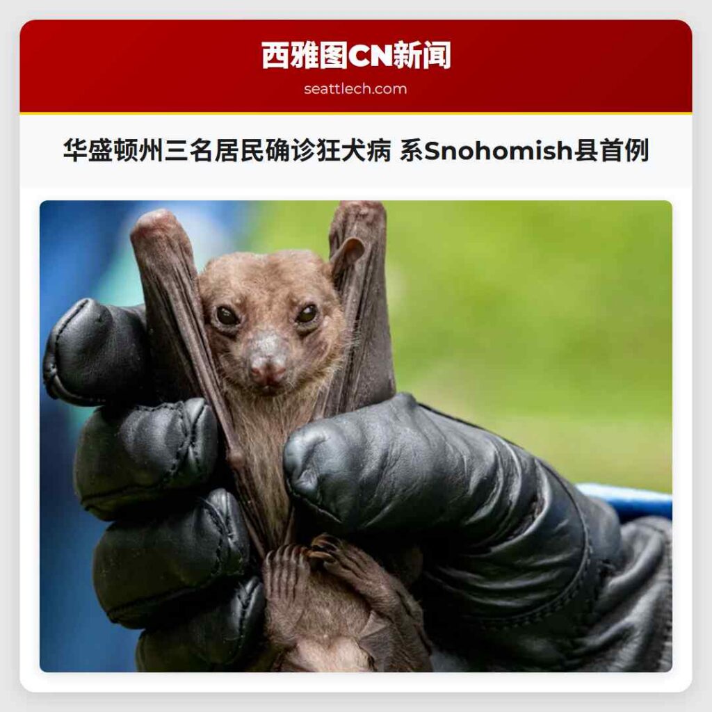 华盛顿州三名居民确诊狂犬病 系Snohomish县首例