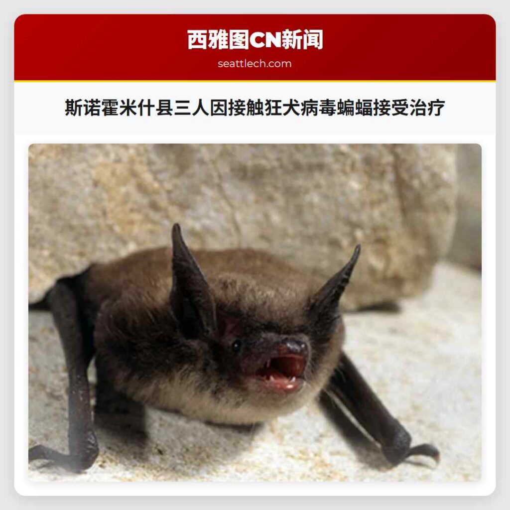 斯诺霍米什县三人因接触狂犬病毒蝙蝠接受治疗