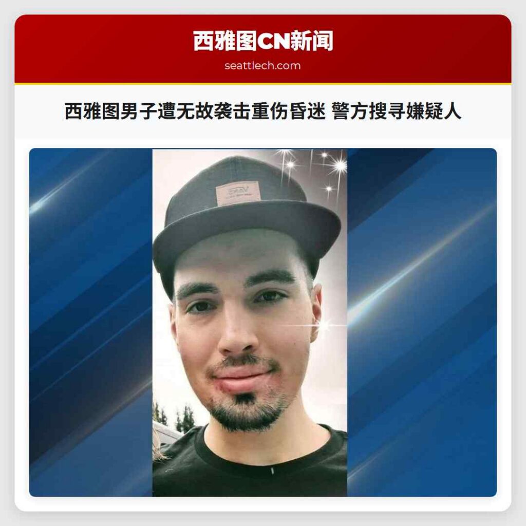西雅图男子遭无故袭击重伤昏迷 警方搜寻嫌疑人